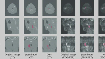 CCUT-Net: Pixel-Wise Global Context Channel Attention UT-Net for Head and Neck Tumor Segmentation featured image