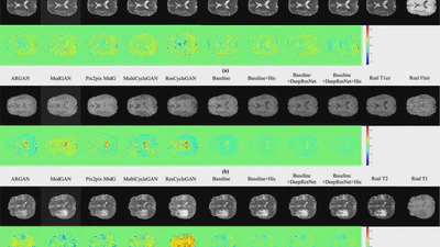 A histogram-driven generative adversarial network for brain MRI to CT synthesis featured image